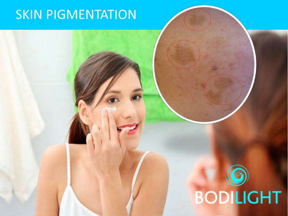 skin pigmentation @bodilight